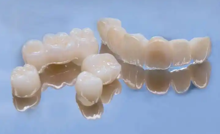 五、选择缺一颗牙补三颗方案，真的是被坑了吗？