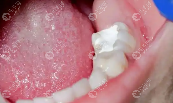 麻涌牙科诊所排名更新！希美/乐雅/象牙等5家，本地人常去口碑稳