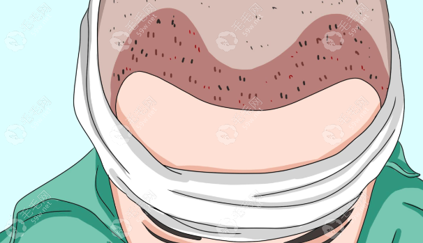 九州植发和雍禾植发哪个好？选武汉九州看毛囊检测，雍禾美学设计更懂年轻人