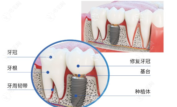 霞浦牙科收费价目表大揭秘!含种植体、牙套等项目,价格差异全知晓