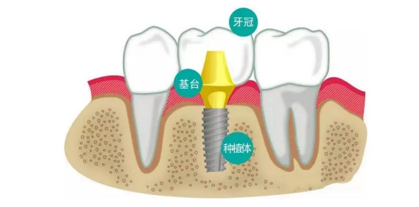 三、屯溪牙科收费价目表性价比评估