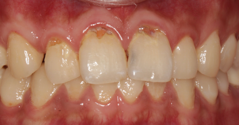 四、惠州新惠口腔就诊注意事项www.59w.net