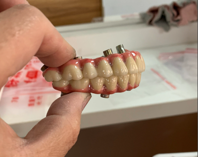 四、术后维护注意事项