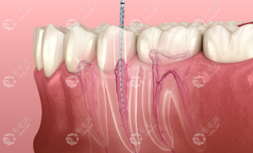 大庆医大口腔根管治疗测评附地址！龙凤区世纪大道店，预约可约周末号
