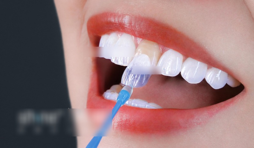 深圳沙井牙科医院收费价格表2026：种植牙6000元起，隐形矫正18000元起含团购优惠价