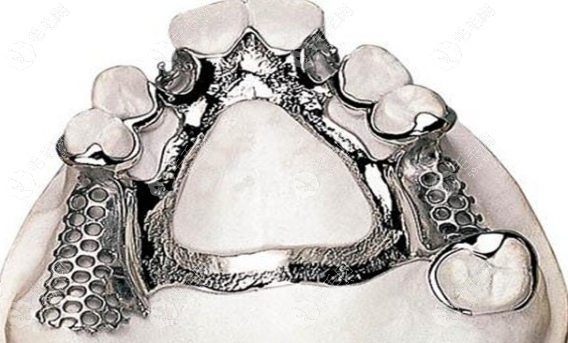 东台全口假牙哪家好？本地3老牌+2社区牙科实测，进口国产不纠结