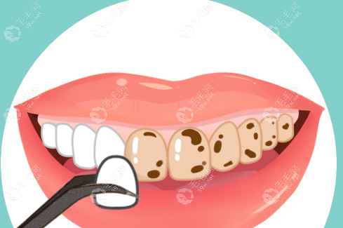 天津大港看牙哪里好？本地人亲测8家牙科，附地址、收费明细