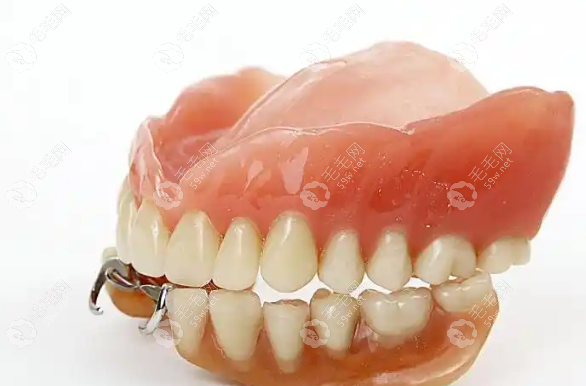 汕头全口吸附性义齿价格到底多少？BPS材质+高吸附力+舒适度，真实体验分享