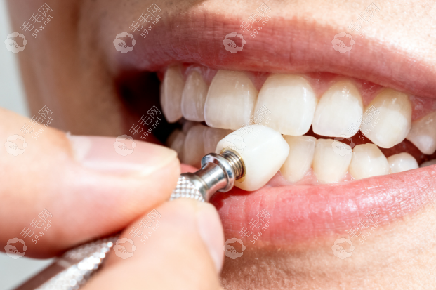 淮北博爱口腔医院做牙冠的医生有哪些？2026名单公布，附价格及预约方式