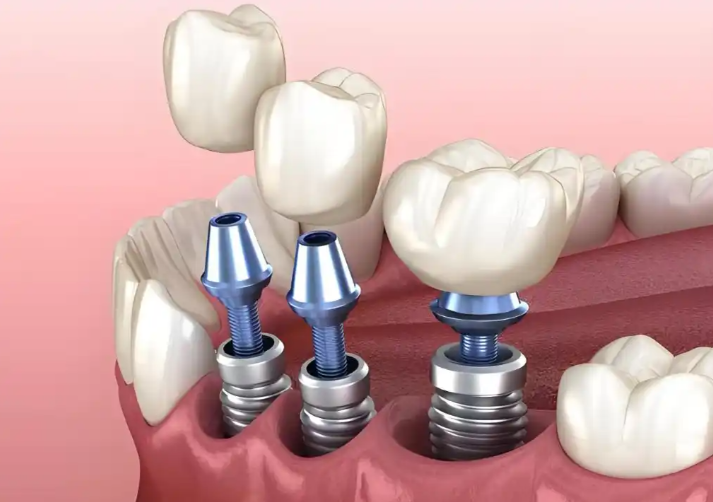 成都西南口腔医院就诊时间安排