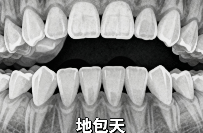 仙桃牙齿矫正价目表：影响价格的关键因素