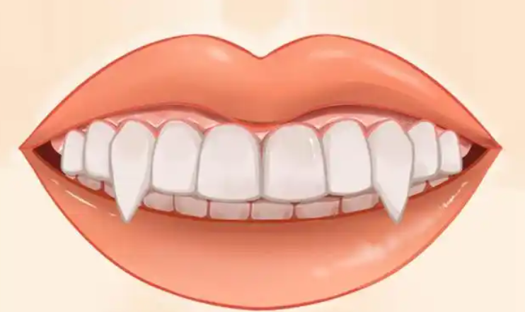 二、虎牙全瓷牙矫正操作流程是怎样的？