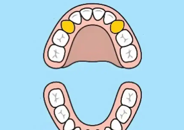 一、虎牙可以做全瓷牙矫正吗？www.59w.net