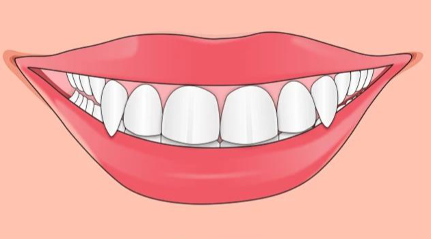 四、虎牙全瓷牙矫正的价格如何？