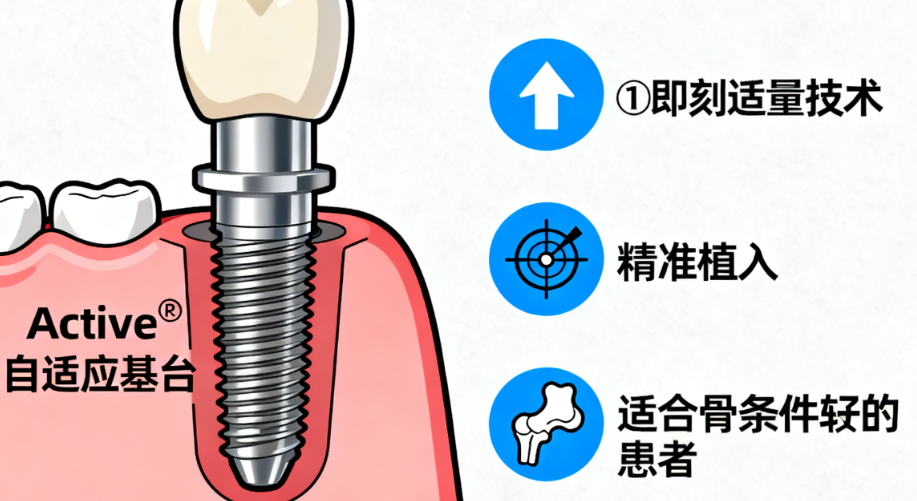 即墨口腔医院种植牙价格明细：韩国登腾5300元起vs瑞士ITI10800元起，材质差异解析