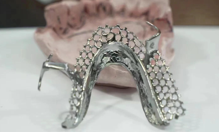 十、哈尔滨全口吸附义齿医院推荐——哈尔滨团圆口腔医院