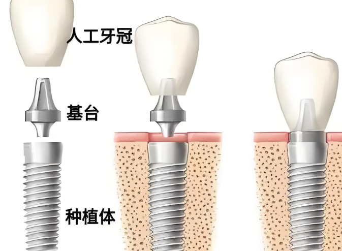 沧州爱齿口腔价格总览