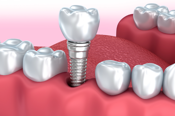  沧州爱齿口腔收费高不高？速看爱齿牙科特色项目与收费情况 