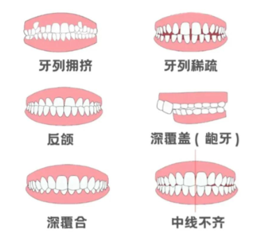特色的矫正项目：隐形矫正，体验升级