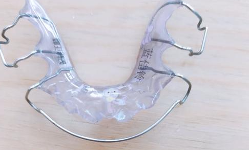 儿童乳牙掉了需要做牙齿间隙保持器吗？家长经验谈，利弊及实例都在这