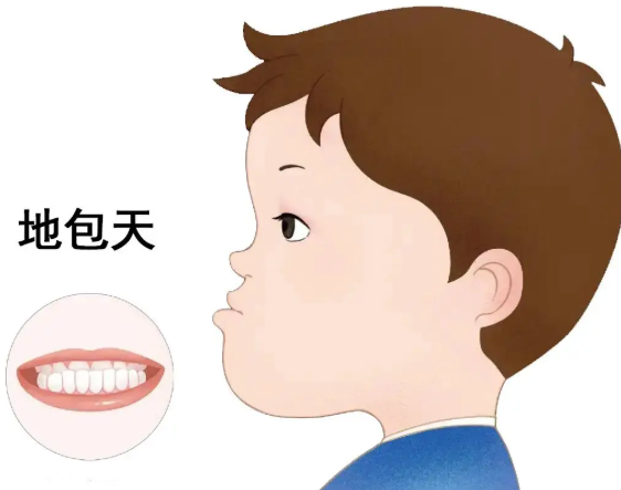 二、地包天矫正改变脸型原理是什么?