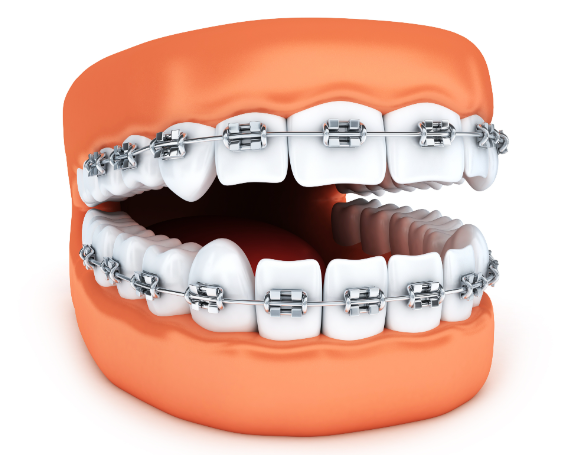 四、适合人群广复杂实例也能应对