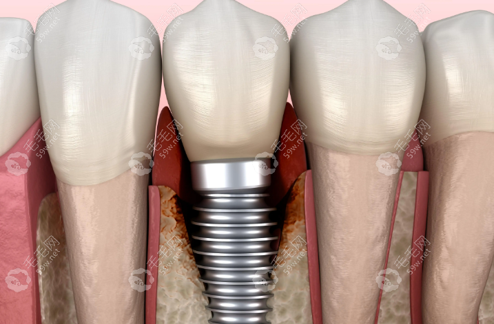 保定美致口腔高飞擅长项目