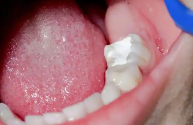 一、格伦菲尔口腔（龙岗布吉店）：连锁有名的里的“性价比较高”www.59w.net