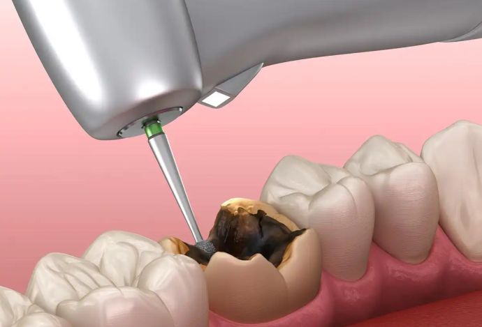 三、正夫口腔（龙岗横岗门诊）：上市牙科品牌，常有实惠活动