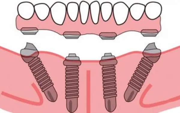 3. 看真实案例，别信