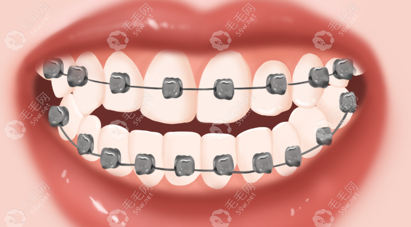西宁摩尔德诺口腔牙齿矫正怎么样？精细评估+舒正畸适体验，收获灿烂笑容