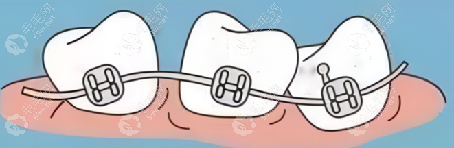 牙齿矫正领域的精深造诣与丰富实践