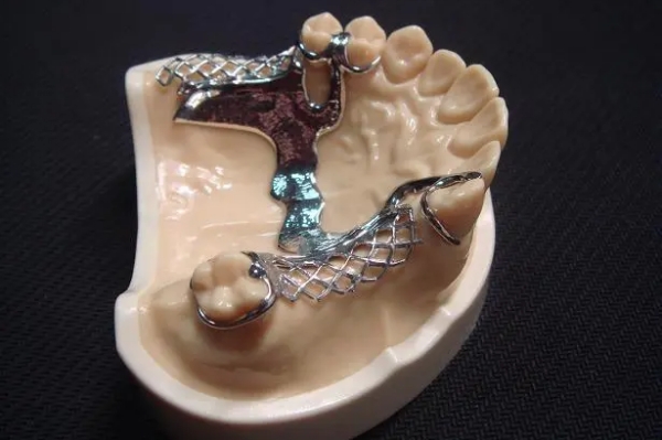 二、PEEK支架义齿的标准化定制流程是怎样的？www.59w.net