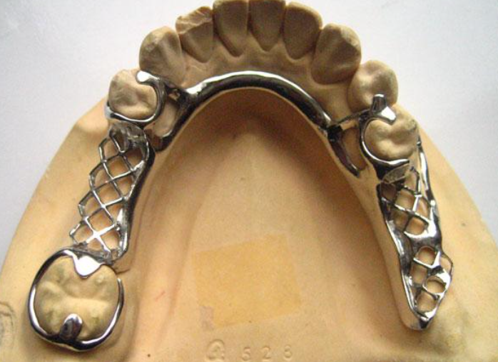 四、济南PEEK支架假牙的收费标准参考www.59w.net