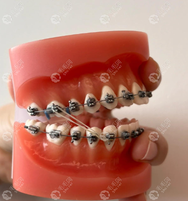 深圳瑞吉口腔诊所执业医师何学莲