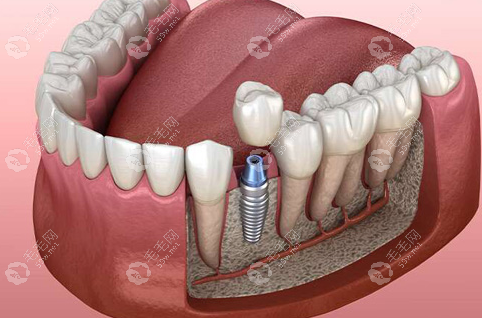 赵彩丽擅长项目 赵彩丽擅长项目