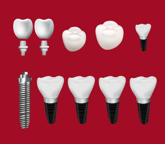 四、广州明瑞口腔诊所价格查询表怎么看才更靠谱