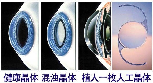 太原华诺和平口腔到底好不好？本地人看牙都在悄悄打听的这家牙科，到底啥水平