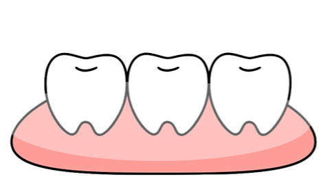 牙龈修补手术别焦虑！这份超全愈合时间线与术后注意事项请收好