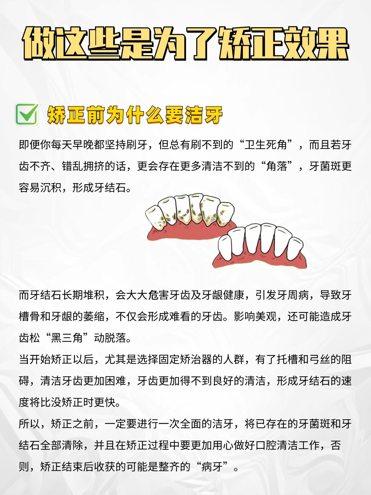五、后牙镶什么牙齿经济耐用不能只看价格