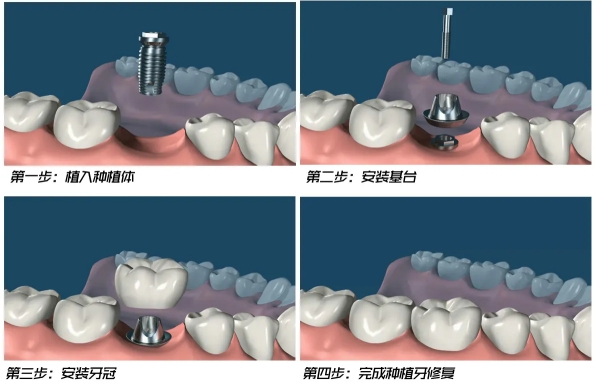 五、其他特色项目：邯郸齿美口腔价格表的全方面覆盖