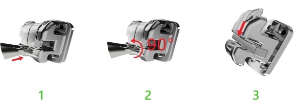 二、 设备技术安不安荃？数字化正畸精细又放心！