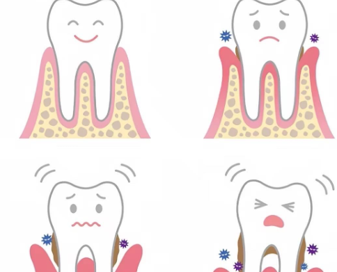 牙龈萎缩是咋回事？牙齿越来越长可能不是错觉而是真的出问题了