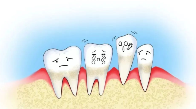 二、牙龈萎缩是咋回事，大多数人都是被这几个原因影响
