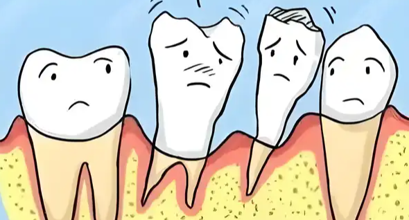 四、牙龈萎缩是咋回事，不只是影响外观那么简单