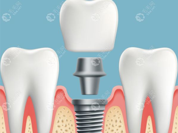 口碑与特色项目
