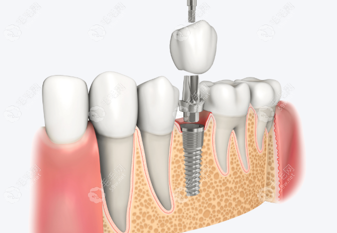 甘肃三旺口腔诊所执业医师白浩