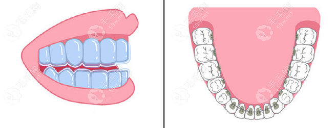 深耕，专注数字化矫正