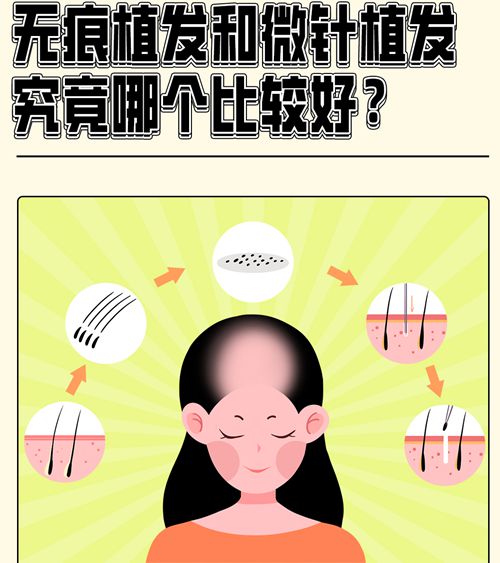 八、发际线种植的真实经历:半年后的整体疗效