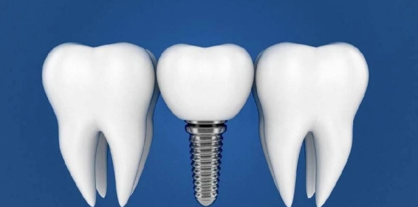 五、儿童牙科专案：守护宝贝的牙齿健康